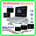 MSLPU34, The Unique laptop ultrasound machine upgraded from MSLPU25, 3D.